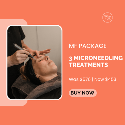 3 x MF Microneedling Package