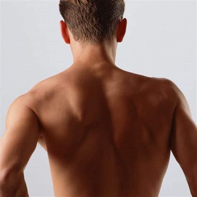 Pre-Pay 5, Get 1 Free Laser Hair Removal - Full Back &amp; Shoulders