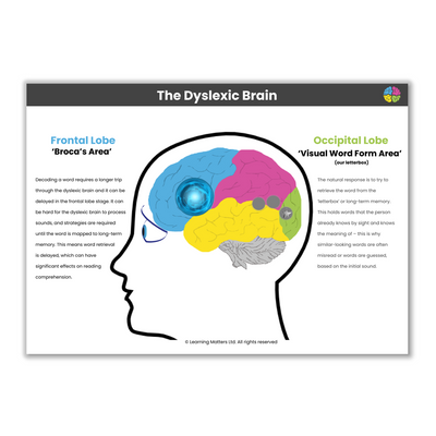 FREE | The Dyslexic Brain - A3 Poster