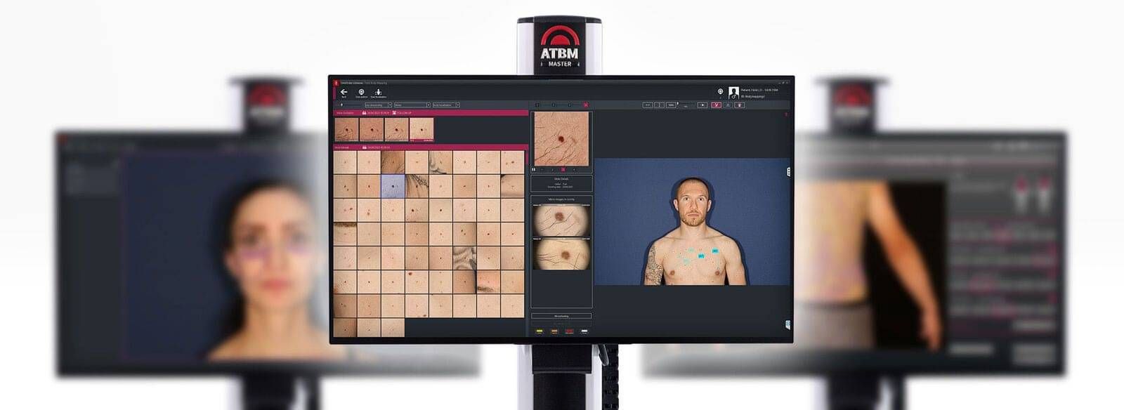 Total Body Mapping | Hamilton Skin Cancer Centre | Hamilton Skin Cancer ...