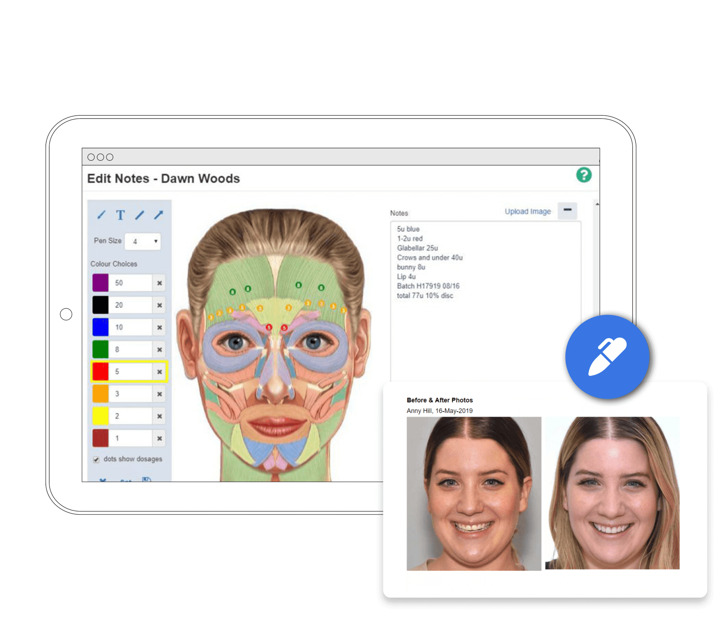 record botox treatments