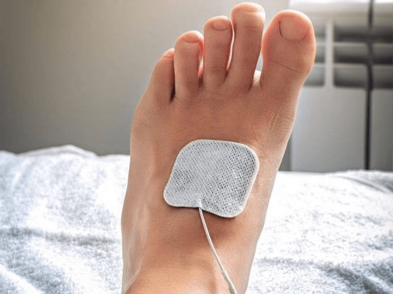 Transcutaneous Electrical Nerve Stimulation