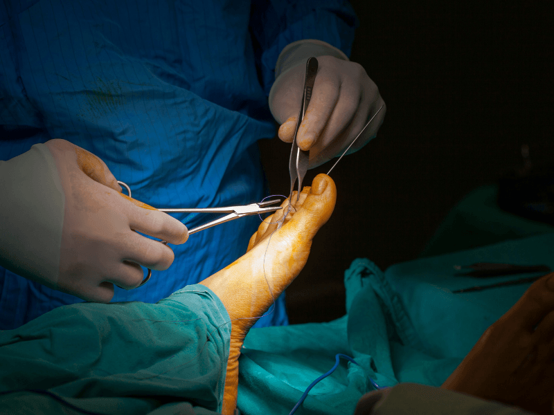 Foot Surgery at Foot Foundation