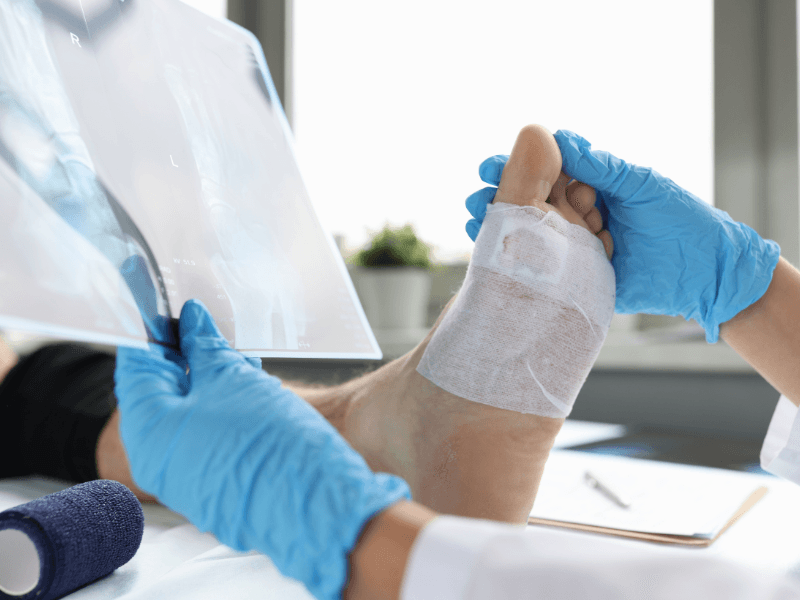 Foot Surgery at Foot Foundation