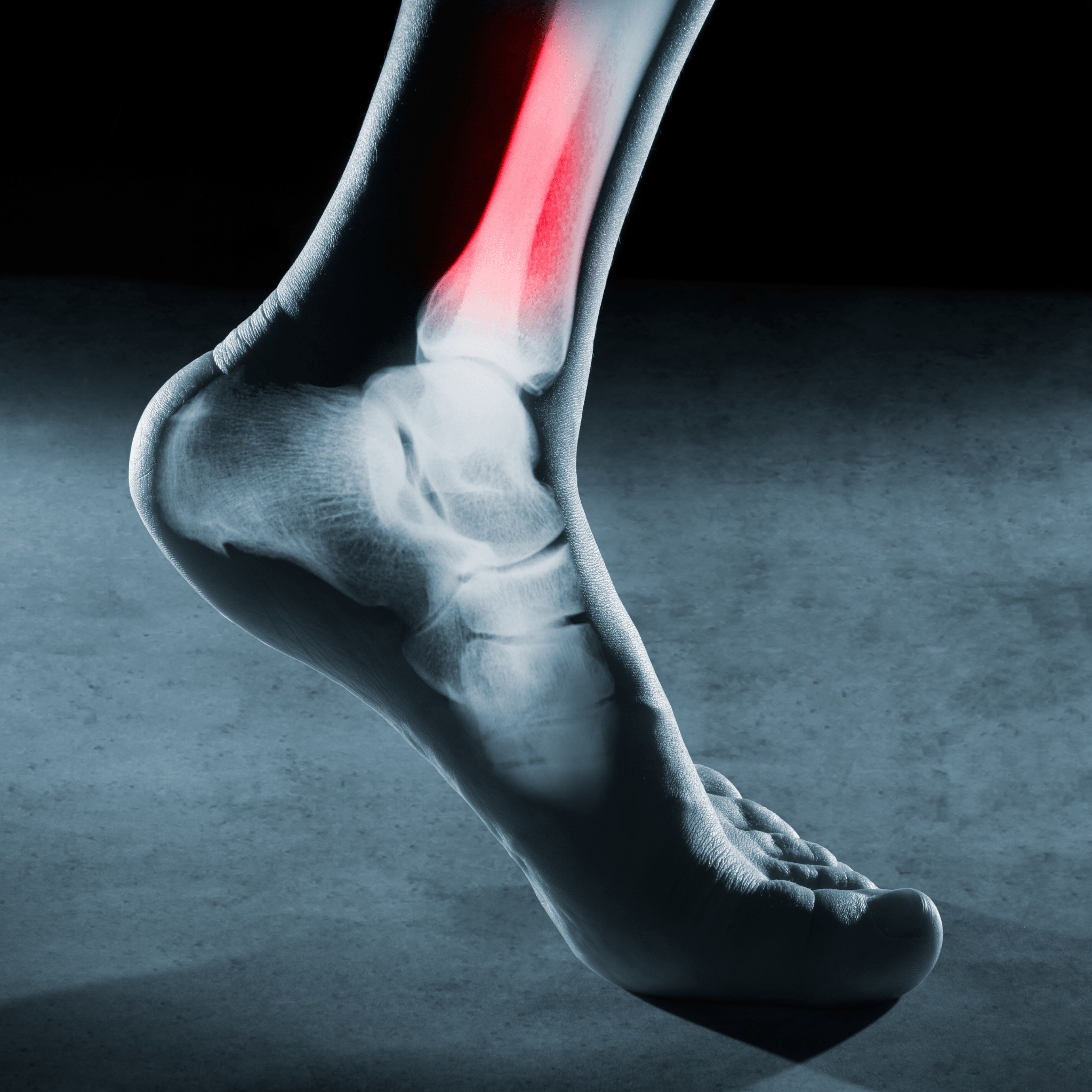 Foot Surgery at Foot Foundation
