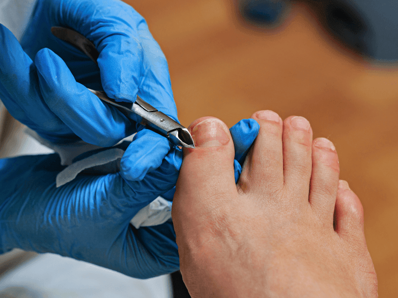 Podiatry Assistant Services at Foot Foundation