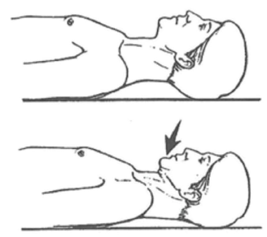 The Neck - Chin Tuck