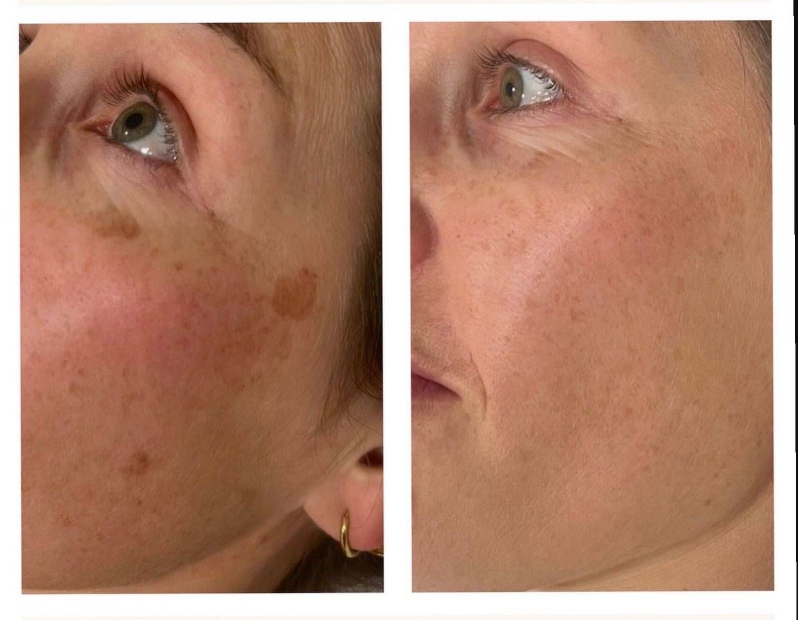 Precision and natural elegance in a cosmetic brow tattoo, meticulously crafted by Keyla Oliver.