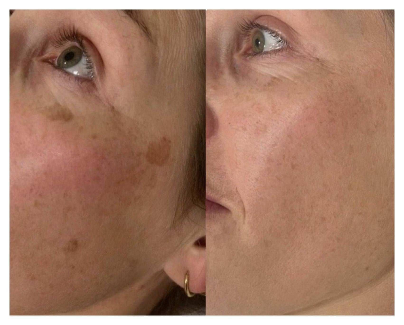 Precision and natural elegance in a cosmetic brow tattoo, meticulously crafted by Keyla Oliver.