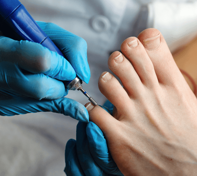 General Nail Care