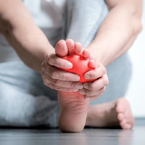 Arch Pain at Foot and Ankle Rehabilitation