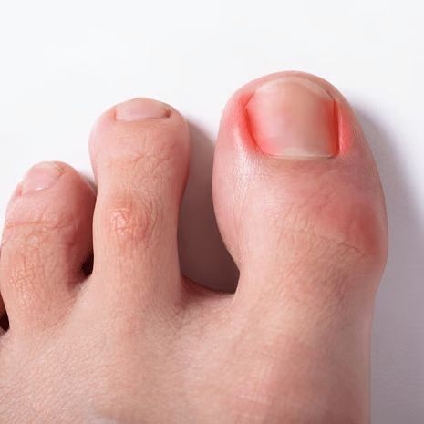 Toe Pain and Toe Conditions Treatment at Foot and Ankle Rehabilitation