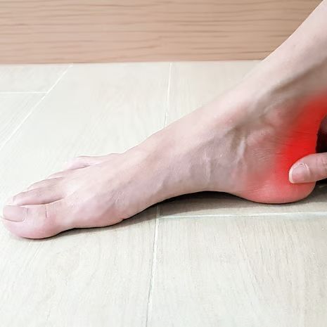 Retrocalcaneal Bursitis Treatment at Foot and Ankle Rehabilitation