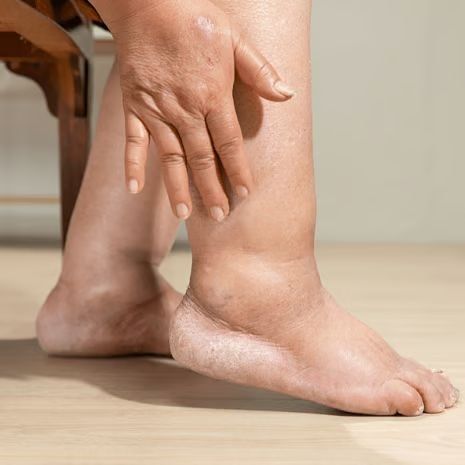 Ankle Arthritis Treatment at Foot and Ankle Rehabilitation
