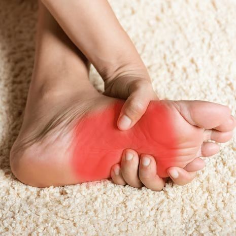 Acccessory Navicular Syndrome Treatment at Foot and Ankle Rehabilitation