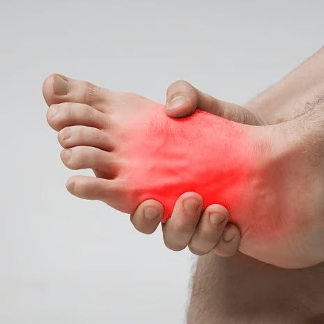 High Arches Pes Cavus Treatment at Foot and Ankle Rehabilitation