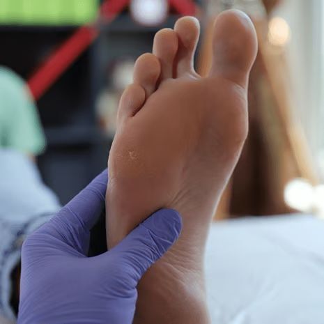 Morton's Neuroma Treatment at Foot and Ankle Rehabilitation