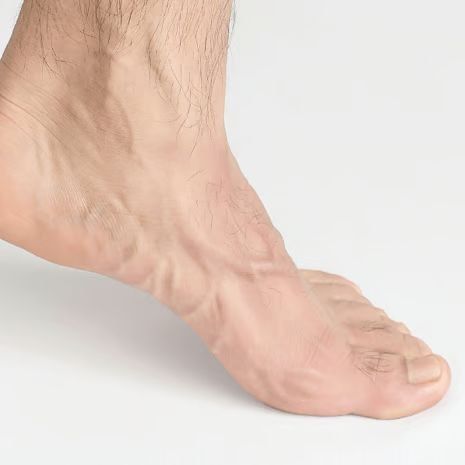 Hallux Limitus Treatment at Foot and Ankle Rehabilitation