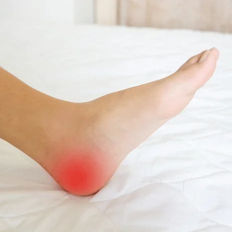 Plantar Fasciitis Treatment at Foot and Ankle Rehabilitation