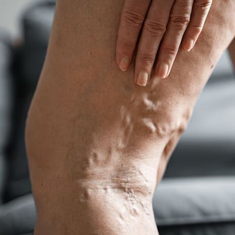 Vascular & Circulatory Leg Issues treatment at Foot and Ankle Rehabilitation