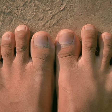 Claw toes treatment at Foot and Ankle Rehabilitation