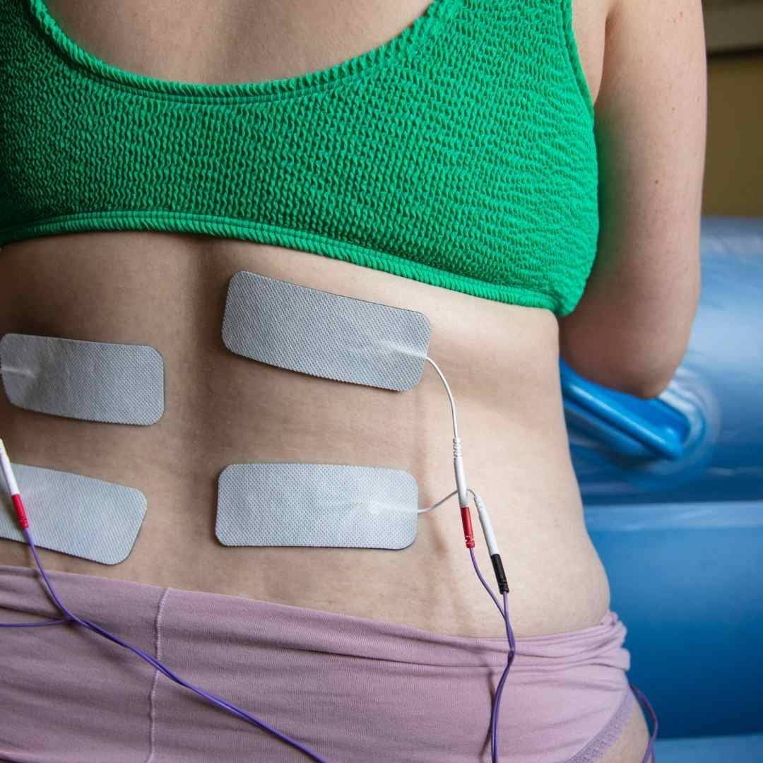 An image showing a māmās back with four TENS electrodes in place