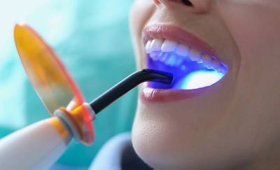 UV Dental Light