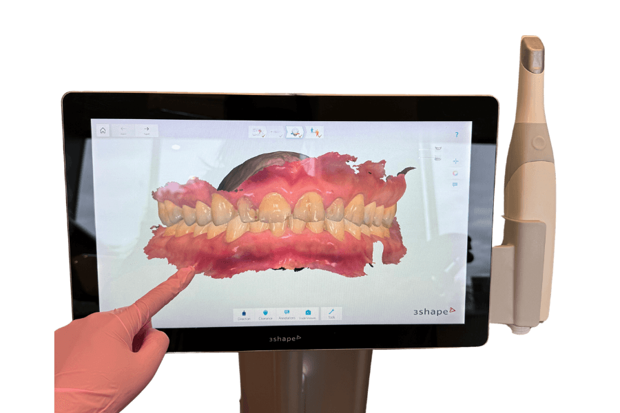 Digital Technology in Dentistry - Enhancing Dental Treatment | Tooth ...