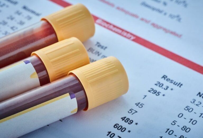 Methamphetamine Testing Rotorua