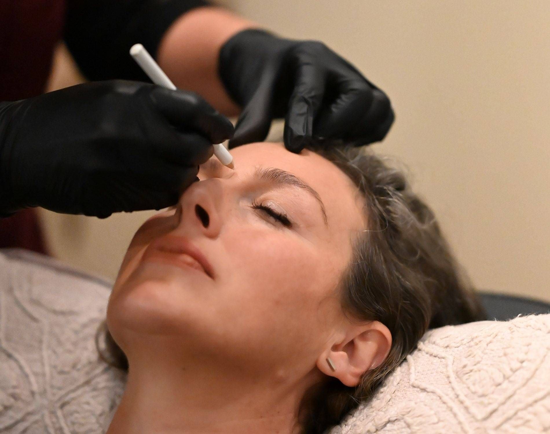 Photo of Kylie preparing for cosmetic treatment